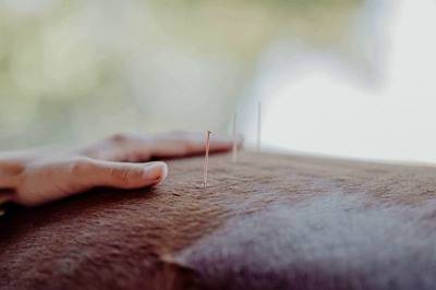 Eine sanfte Hand neben Akupunkturnadeln, die in die Haut eines Pferdes eingesetzt werden, demonstriert die Akupunkturtherapie.
